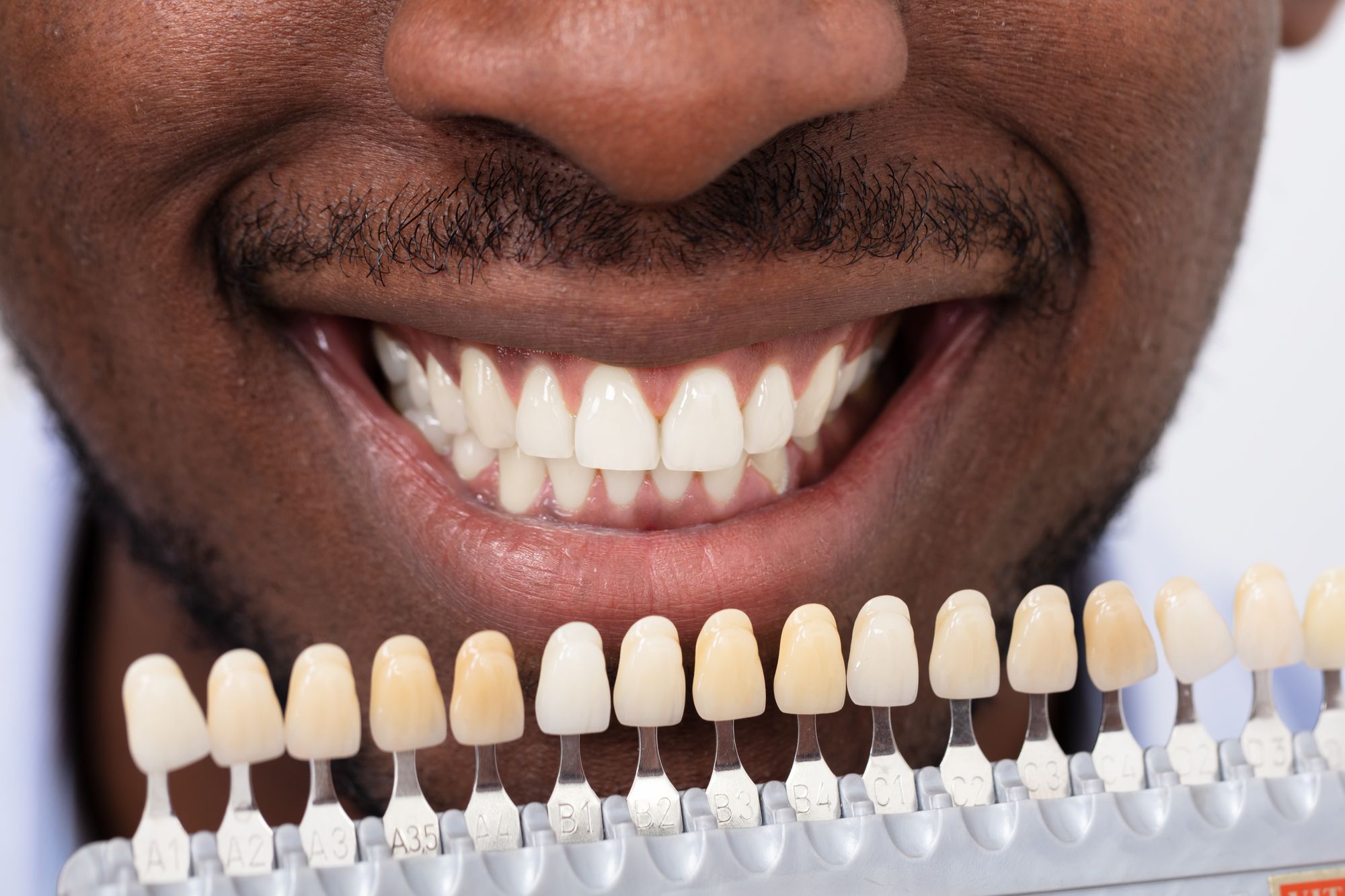 man looking at different colors for his dental veneers in Vancouver, WA