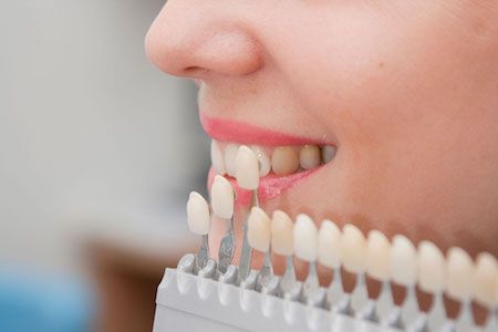 woman looking at veneers for her smile makeover in Vancouver, WA